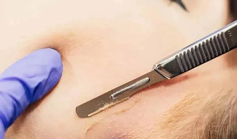 service thumb